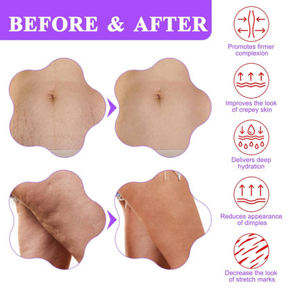 Tighten & Smooth Belly Cream - Advanced Firming Lotion for Neck, Arms, Butt & Thighs | Visibly Lift Loose Skin, Improve Elasticity & Tone