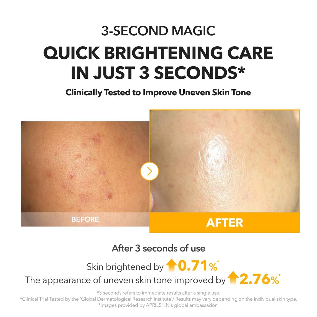APRILSKIN A.C.E Serum - Vita Kojic Serum for Brightening & Glow, 3-Second Brightening, Kojic Acid & Vitamin C for Uneven Skin Tone, Korean Skin Care, 3.88 oz - görsel 8
