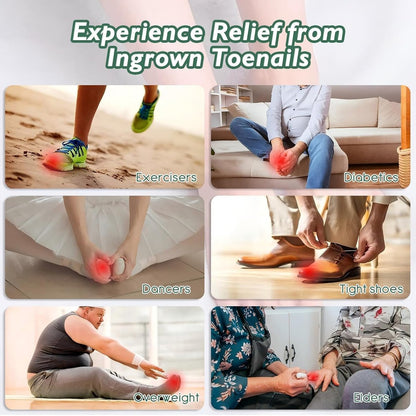 Ingrown Toenail Treatment Kit – 30ml Softening & Conditioning Solution with Silicone Gel Toe Caps for Easy Trimming and Relief