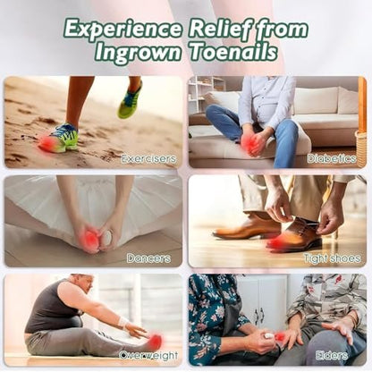 Ingrown Toenail Treatment Kit – 30ml Softening & Conditioning Solution with Silicone Gel Toe Caps for Easy Trimming and Relief