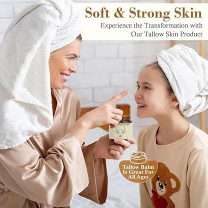 SURORAIN Whipped Tallow Honey Lip Balm & Body Balm – Grass-Fed Tallow Skin Cream for Deep Moisturization, Dry Skin Relief Avelisse
