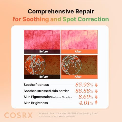 COSRX 5 PDRN B5 Vital Soothing Toner – Korean Skin Care with Salmon DNA & Panthenol (280ml/9.46 fl.oz.) - görsel 14