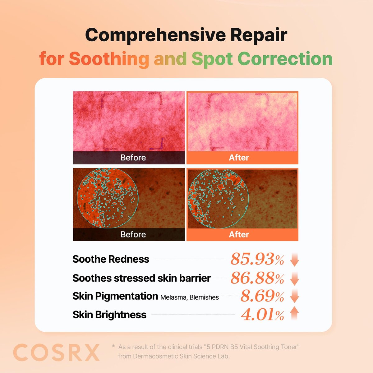 COSRX 5 PDRN B5 Vital Soothing Toner – Korean Skin Care with Salmon DNA & Panthenol (280ml/9.46 fl.oz.) - görsel 13