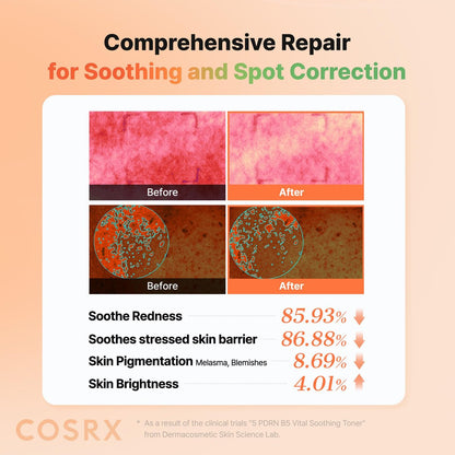 COSRX 5 PDRN B5 Vital Soothing Toner – Korean Skin Care with Salmon DNA & Panthenol (280ml/9.46 fl.oz.)