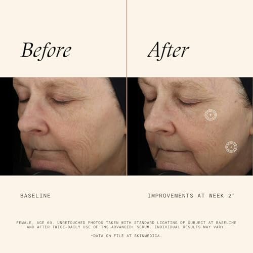 SkinMedica TNS Advanced+ Face Serum - Multi Peptide Serum to Reduce Wrinkles, Fine Lines, Improve Skin Tone & Texture (1 oz) Avelisse