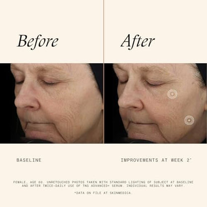 SkinMedica TNS Advanced+ Face Serum - Multi Peptide Serum to Reduce Wrinkles, Fine Lines, Improve Skin Tone & Texture (1 oz) Avelisse