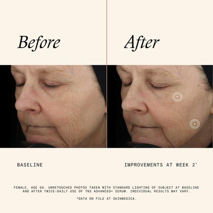 SkinMedica TNS Advanced+ Face Serum - Multi Peptide Serum to Reduce Wrinkles, Fine Lines, Improve Skin Tone & Texture (1 oz) Avelisse