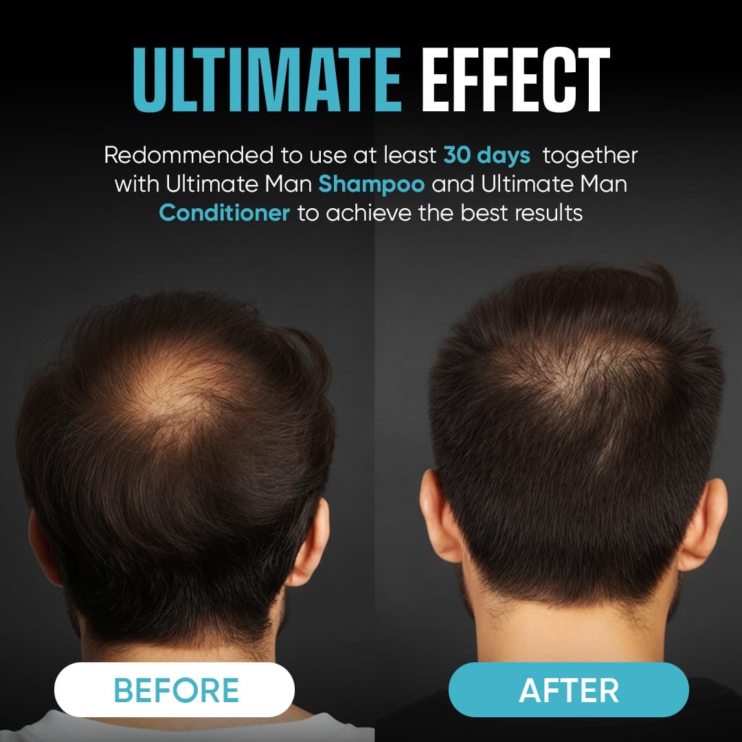 Moerie Ultimate Men Hair Growth Spray – Biotin & Rosemary Hair Loss Solution for Thinning Hair, 5.07 Fl Oz Avelisse