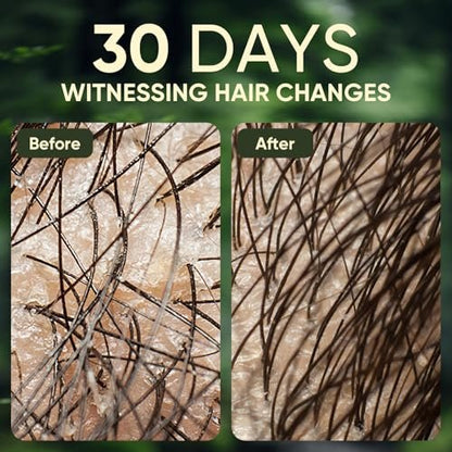 Batana Oil & Rosemary Shampoo for Hair Growth – Reduces Hair Loss, Restores Vitality, Stimulates Regrowth for Men & Women (10.58 fl oz)