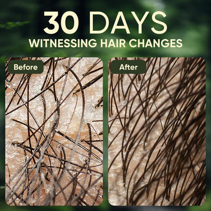 Batana Oil & Rosemary Shampoo for Hair Growth – Reduces Hair Loss, Restores Vitality, Stimulates Regrowth for Men & Women (10.58 fl oz)
