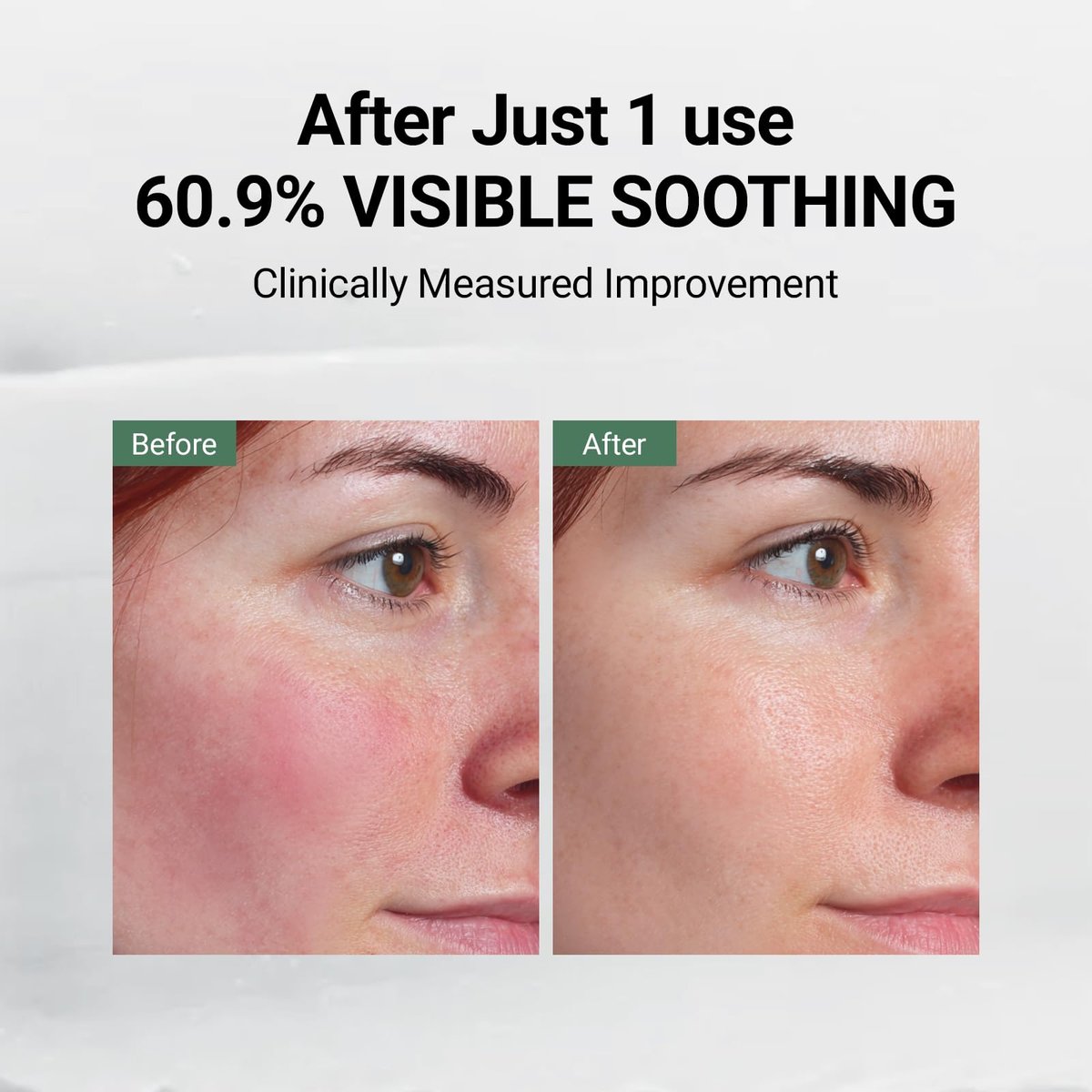 DA EFFECT Post Care Balm - Advanced Barrier Repair Moisturizer with GINSTECAX™, Soothes Sensitive Skin & Relieves Redness, 30ml Avelisse