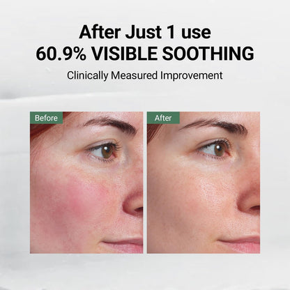 DA EFFECT Post Care Balm - Advanced Barrier Repair Moisturizer with GINSTECAX™, Soothes Sensitive Skin & Relieves Redness, 30ml Avelisse