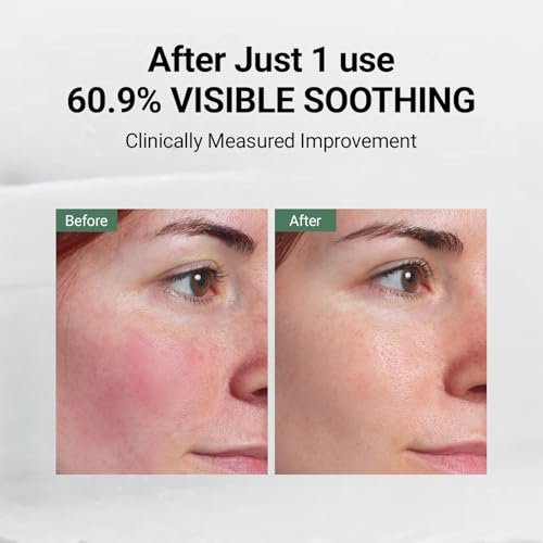 DA EFFECT Post Care Balm - Advanced Barrier Repair Moisturizer with GINSTECAX™, Soothes Sensitive Skin & Relieves Redness, 30ml Avelisse