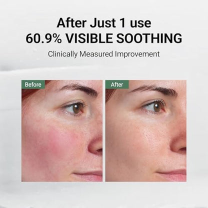 DA EFFECT Post Care Balm - Advanced Barrier Repair Moisturizer with GINSTECAX™, Soothes Sensitive Skin & Relieves Redness, 30ml Avelisse