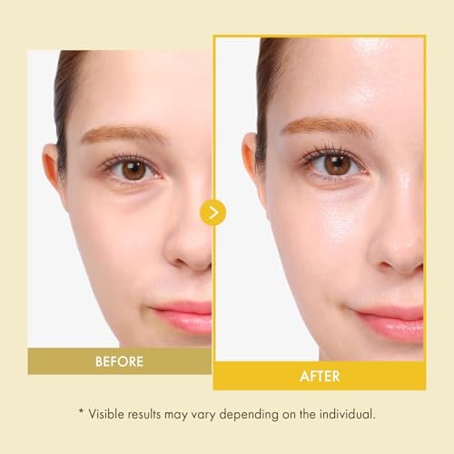 TOSOWOONG Rice Glow Spray Serum – 70% Rice Bran Water, Vitamin C, Kojic Acid, Glutathione, Hyaluronic Acid, PDRN – Hydrating All In One Face Mist for Glass Skin – Korean Skincare, 100ml Avelisse