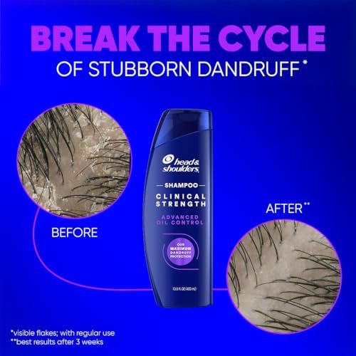 Head & Shoulders Clinical Strength Advanced Oil Control Dandruff Shampoo, Prescription-Strength Flake Protection, Citrus Scent, 13.5 Fl Oz Avelisse