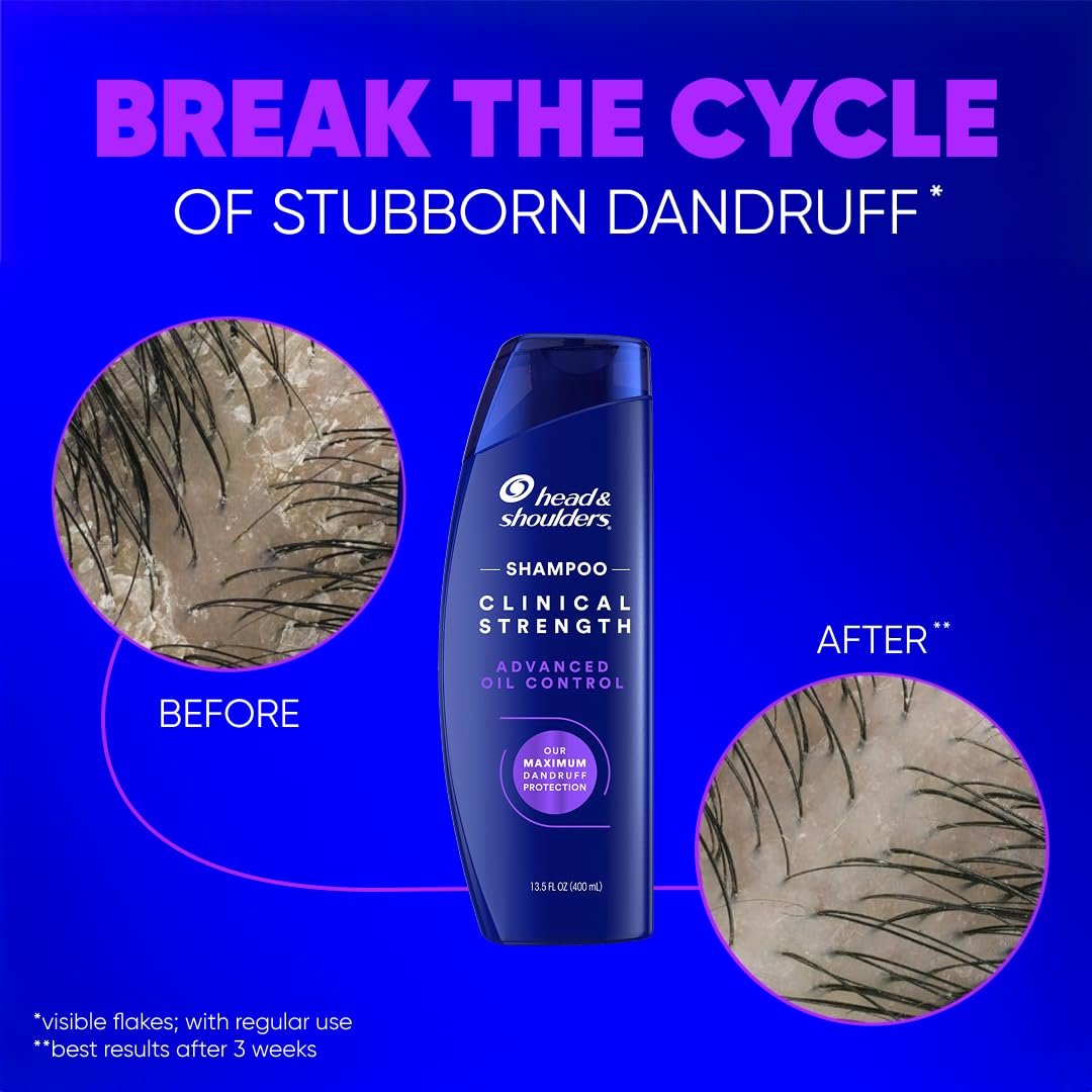 Head & Shoulders Clinical Strength Advanced Oil Control Dandruff Shampoo, Prescription-Strength Flake Protection, Citrus Scent, 13.5 Fl Oz Avelisse