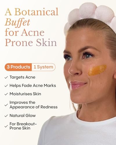 Frøya Organics The Complete Blemish System for Women – 60-Day Supply with Magic Revive & Glow Day Balm, Ultra Cleanse & Revive Face Scrub, Instant Rosacea, Acne & Redness Stopper Avelisse