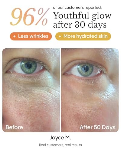 FRØYA Organics Hyper Potent Dark Circles & Eye Bag Balm – Water-Free Beeswax Treatment with Arctic Arnica, Pomegranate & Rosehip for Smoother, Refreshed Eyes (15ml) Avelisse