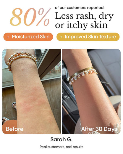 FRØYA Organics Soothing Relief Balm for Red Itchy Flaky Skin – Blue Chamomile & Thistle – Natural Face & Body Moisturizer for Chronic Dryness – 100ml Avelisse
