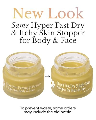 FRØYA Organics Soothing Relief Balm for Red Itchy Flaky Skin – Blue Chamomile & Thistle – Natural Face & Body Moisturizer for Chronic Dryness – 100ml Avelisse