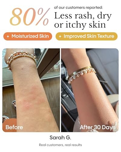 FRØYA Organics Soothing Relief Balm for Red Itchy Flaky Skin – Blue Chamomile & Thistle – Natural Face & Body Moisturizer for Chronic Dryness – 100ml Avelisse