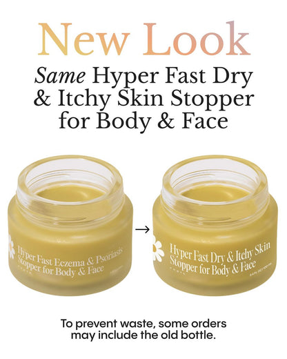 FRØYA Organics Soothing Relief Balm for Red Itchy Flaky Skin – Blue Chamomile & Thistle – Natural Face & Body Moisturizer for Chronic Dryness – 100ml Avelisse