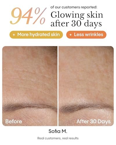 FRØYA Organics Magic Revive & Glow Day Balm - Nourishing Face Moisturizer with Sea Buckthorn & Rosehip, Water-Free Formula for Smooth, Healthy-Looking Skin, 30ml Avelisse