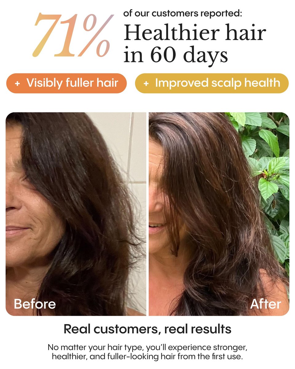Frøya Organics The Complete System For Mature Hair & Scalp | Scalp Balance & Fuller Looking Hair | Rosemary, Pumpkin Seed, Turmeric, Calendula | Botanical Formula | 60 Day Supply Avelisse