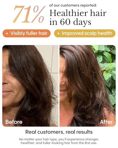 Frøya Organics The Complete System For Mature Hair & Scalp | Scalp Balance & Fuller Looking Hair | Rosemary, Pumpkin Seed, Turmeric, Calendula | Botanical Formula | 60 Day Supply Avelisse