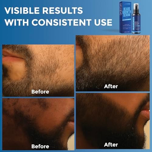 Manemen Beard Growth Serum Spray - Biotin, Castor Oil, Vitamin B5 & B12 - Natural Hair Regrowth Formula for Thicker, Fuller, Stronger Beard Avelisse