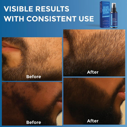 Manemen Beard Growth Serum Spray - Biotin, Castor Oil, Vitamin B5 & B12 - Natural Hair Regrowth Formula for Thicker, Fuller, Stronger Beard Avelisse