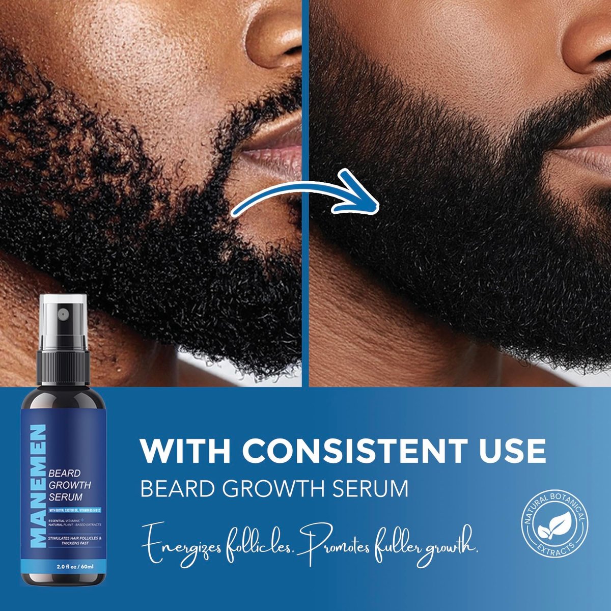 Manemen Beard Growth Serum Spray - Biotin, Castor Oil, Vitamin B5 & B12 - Natural Hair Regrowth Formula for Thicker, Fuller, Stronger Beard Avelisse