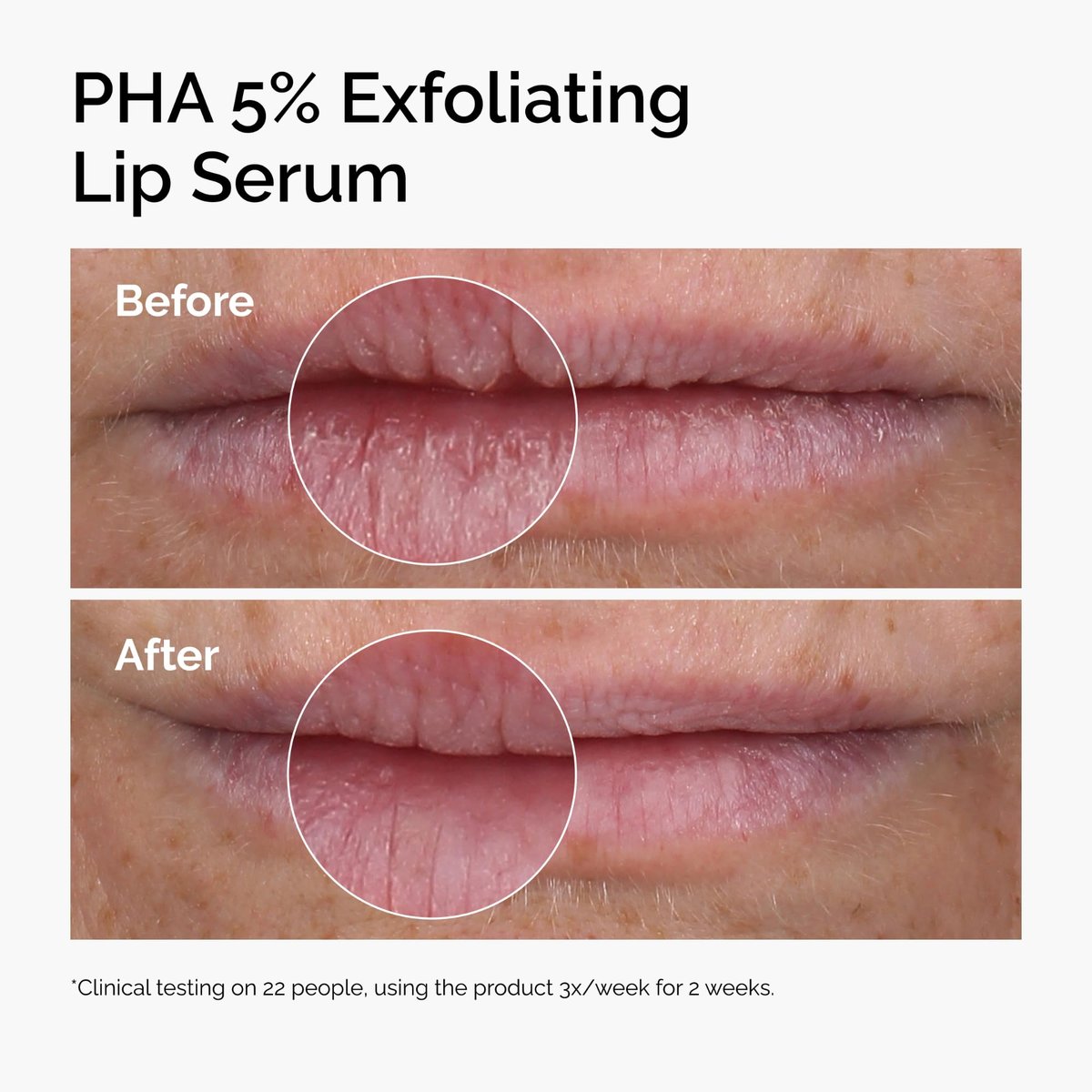 The Ordinary PHA 5% Exfoliating Lip Serum - Hydrating Overnight Lip Exfoliator Treatment 0.5 Fl Oz - görsel 5