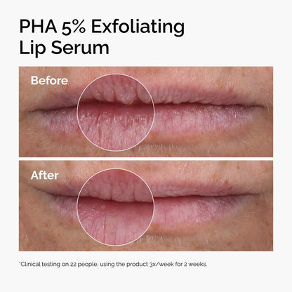 The Ordinary PHA 5% Exfoliating Lip Serum - Hydrating Overnight Lip Exfoliator Treatment 0.5 Fl Oz