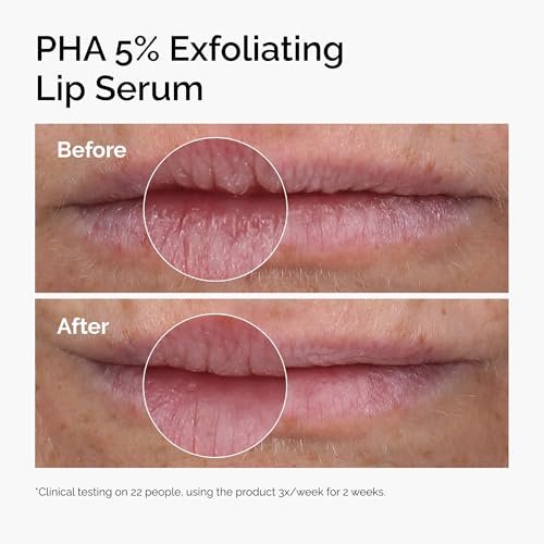 The Ordinary PHA 5% Exfoliating Lip Serum - Hydrating Overnight Lip Exfoliator Treatment 0.5 Fl Oz - görsel 6