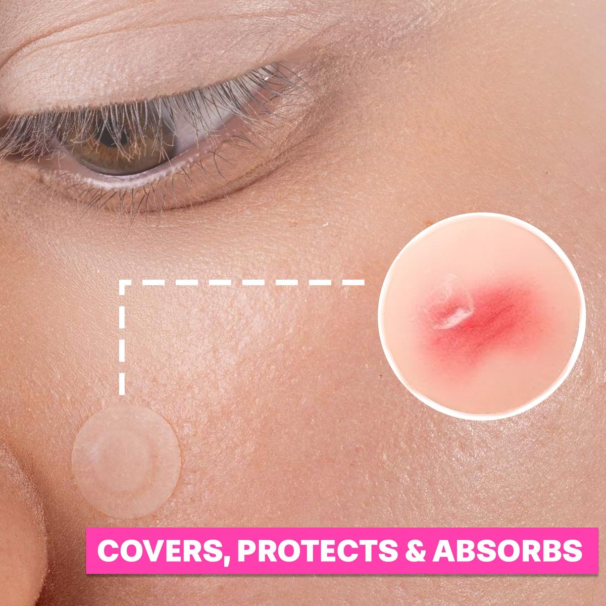 LUNAVERA Hydrocolloid Spot Cover Patches – 72 Count, 8mm & 12mm Thin Clear Face Stickers for Discreet Daily Wear - görsel 13