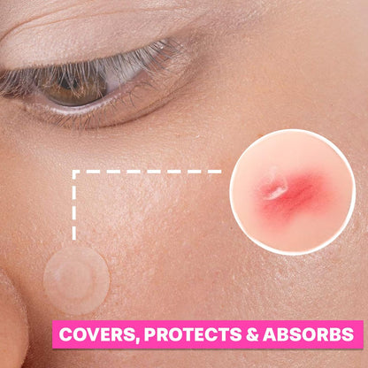 LUNAVERA Hydrocolloid Spot Cover Patches – 72 Count, 8mm & 12mm Thin Clear Face Stickers for Discreet Daily Wear