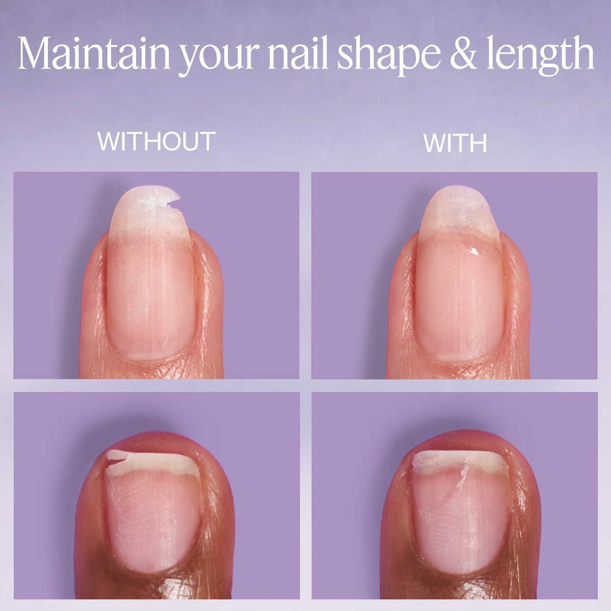 essie Break Fix Liquid Nail Patch – Nail Repair for Damaged, Split & Weak Nails (0.23 fl oz) - görsel 7