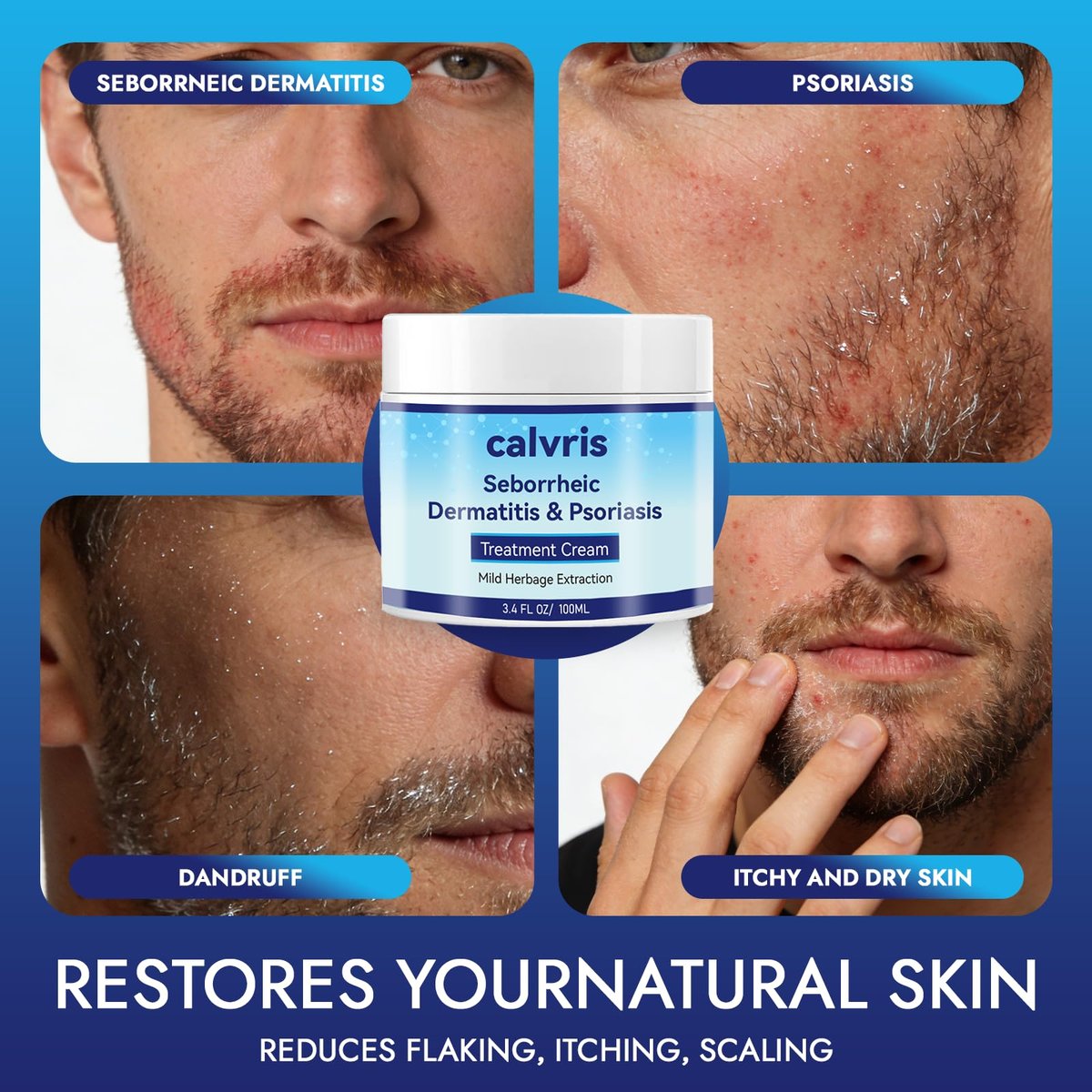 Calvris Scalp Comfort Balm - Steroid-Free Botanical Formula for Dry, Itchy Scalp & Skin, 3.4 Fl Oz | Natural Soothing Relief with Cooling Sensation Avelisse
