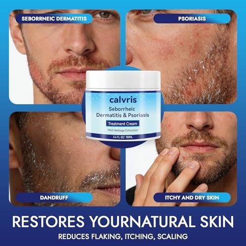 Calvris Scalp Comfort Balm - Steroid-Free Botanical Formula for Dry, Itchy Scalp & Skin, 3.4 Fl Oz | Natural Soothing Relief with Cooling Sensation Avelisse