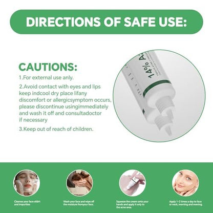 14% Azelaic Acid Serum for Face – Gentle Acne & Redness Treatment, Calms Sensitive Skin, Improves Blemishes & Uneven Tone, Lightweight Formula 1oz