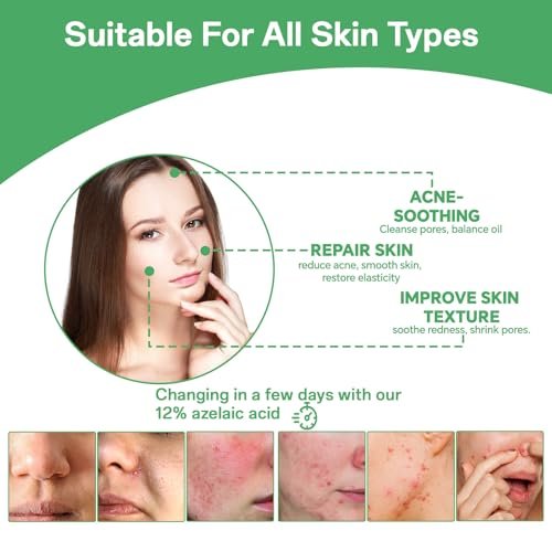 14% Azelaic Acid Serum for Face – Gentle Acne & Redness Treatment, Calms Sensitive Skin, Improves Blemishes & Uneven Tone, Lightweight Formula 1oz - görsel 14