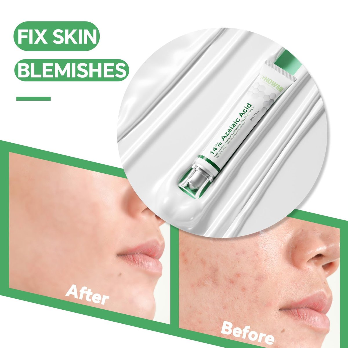 14% Azelaic Acid Serum for Face – Gentle Acne & Redness Treatment, Calms Sensitive Skin, Improves Blemishes & Uneven Tone, Lightweight Formula 1oz - görsel 7