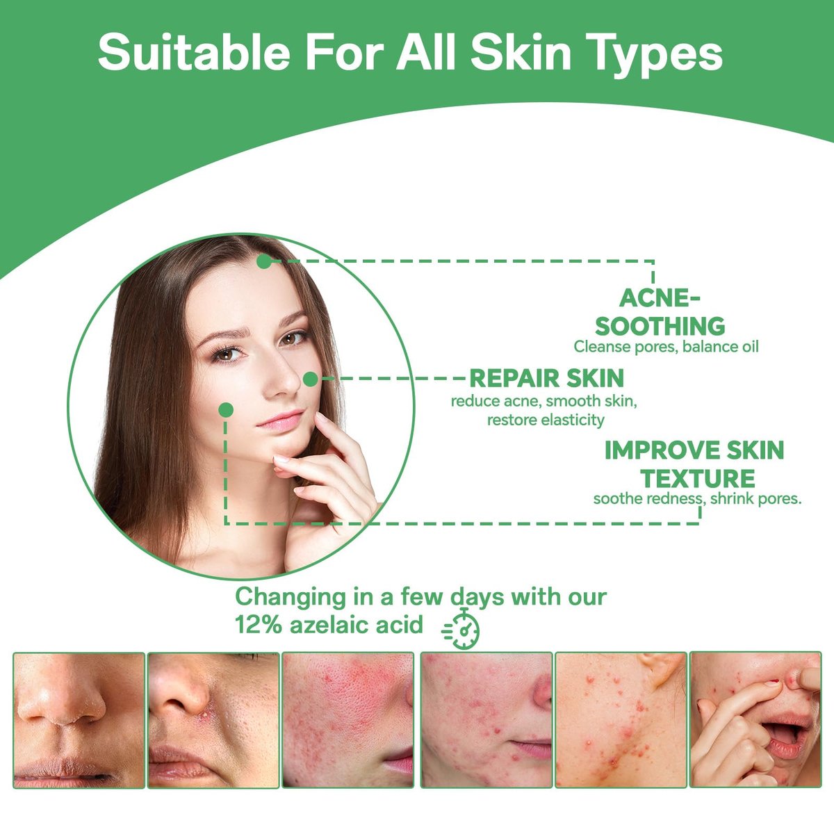 14% Azelaic Acid Serum for Face – Gentle Acne & Redness Treatment, Calms Sensitive Skin, Improves Blemishes & Uneven Tone, Lightweight Formula 1oz - görsel 13