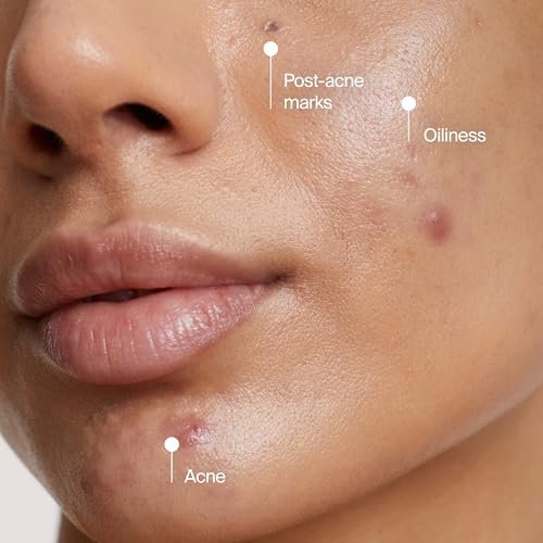 Neutrogena Evenly Clear Acne Cleansing Face Mask with 3.5% Benzoyl Peroxide & Bentonite Clay, Purifying Clay Mask Absorbs Oil to Visibly Improve Skin, 4.2 fl. oz - görsel 16
