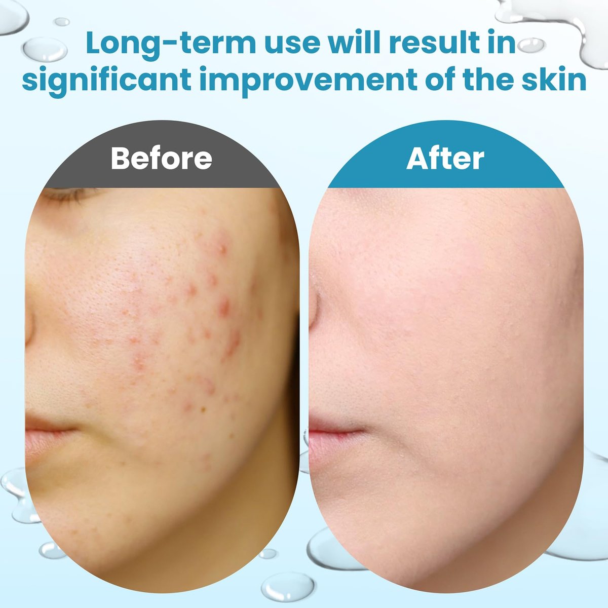 Glycolic Acid Resurfacing Pads – 15% Ultra Pure Glycolic Acid & 2% Salicylic Acid Exfoliating Peel for Face, Smooth Skin, Wrinkle Prevention, Radiant Skin Renewal – 60 Pads - görsel 7