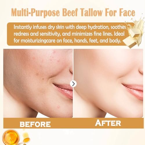 Organic Grass-Fed Beef Tallow Balm for Face and Body – Natural Tallow and Honey Moisturizer (2 oz) - görsel 12