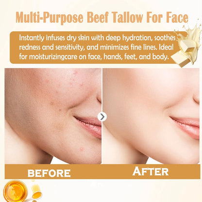 Organic Grass-Fed Beef Tallow Balm for Face and Body – Natural Tallow and Honey Moisturizer (2 oz)