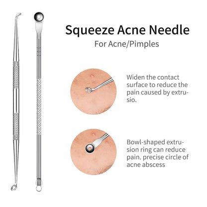GERY Blackhead Remover Pimple Popper Tool – Versatile Use: Suitable for removing blackheads, whiteheads, pimples, – Image 5